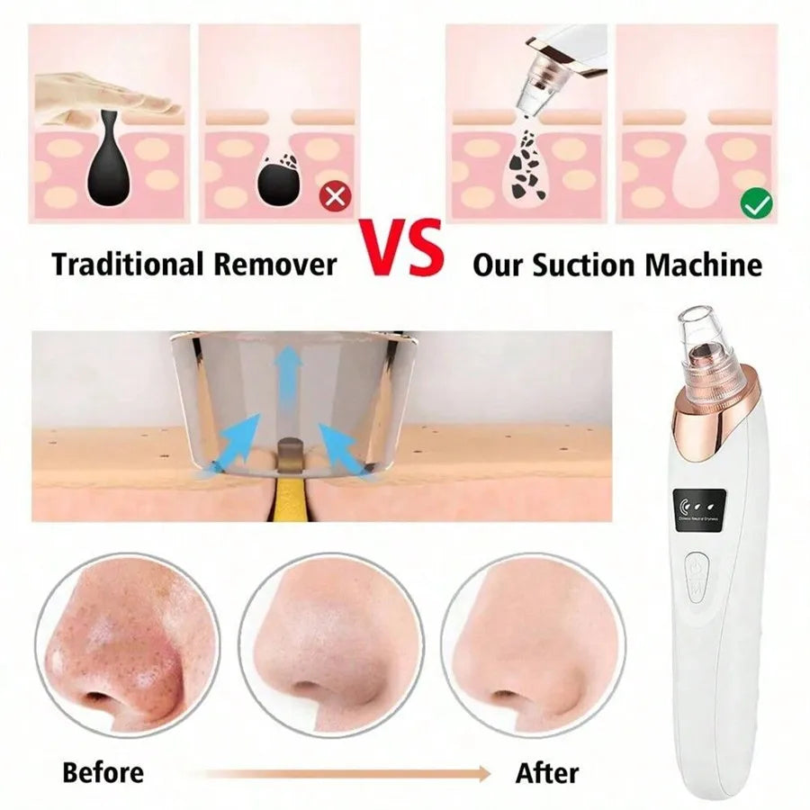 5-in-1 Electric Blackhead Vacuum Pore Cleaner with LCD Display – Facial Deep Cleansing & Acne Removal