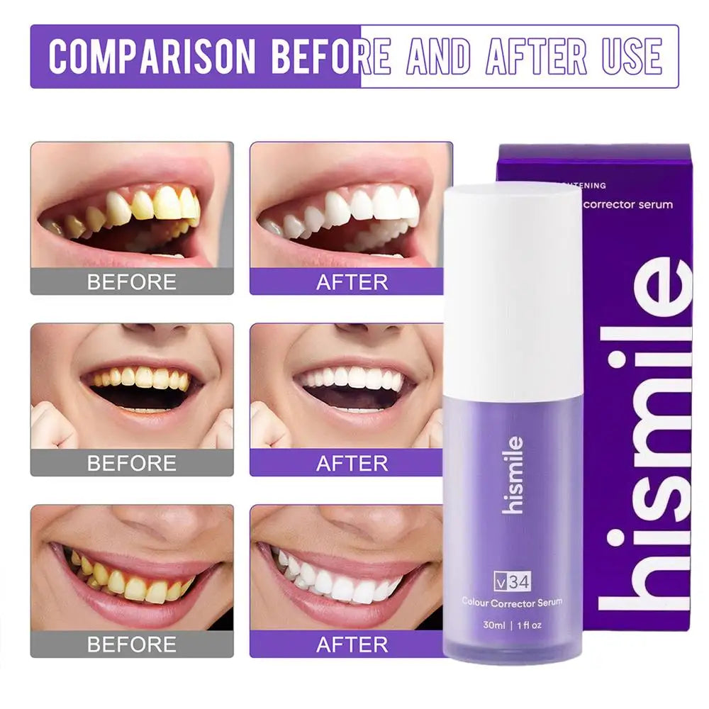 HISMILE V34 Purple Toothpaste Kit | Advanced Teeth Whitening